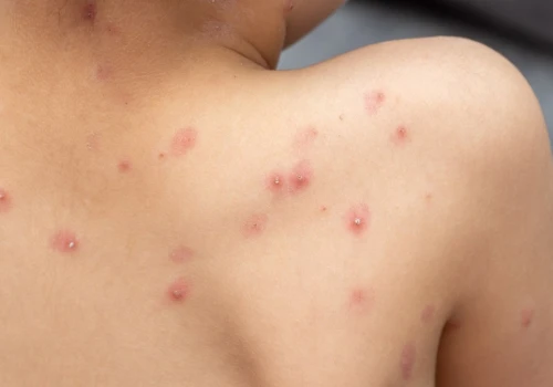 To wina Brytyjczyków. Poznaliśmy przyczynę niszczycielskiej epidemii z 1789