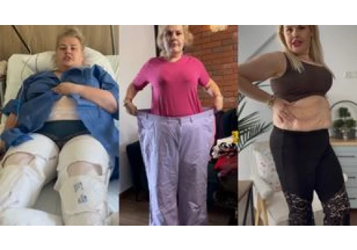 Kinga Zawodnik ważyła 149 kg. Teraz wspomina swoją przemianę. 