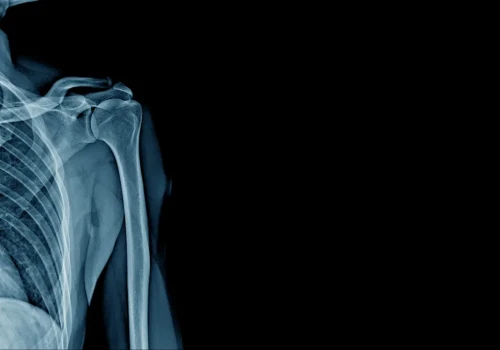 Czy inhibitory pompy protonowej zwiększają ryzyko osteoporozy?