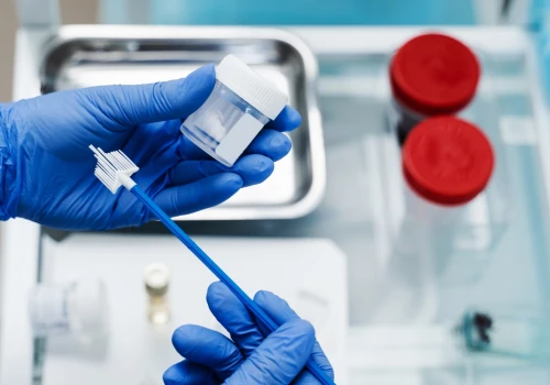 Badanie cytologiczne zastąpi test HPV HR