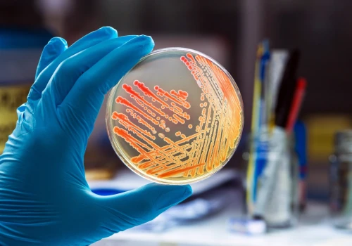 Wymaz, posiew, antybiogram… Jak czytać wyniki badań mikrobiologicznych?