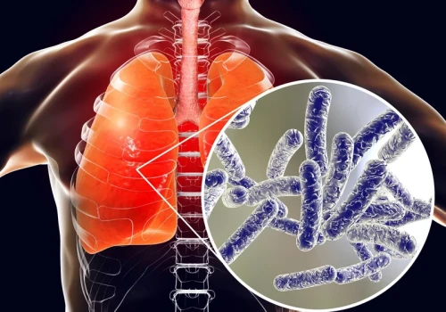 Legionella może namnażać się w instalacji wodnej. Tych objawów nie lekceważ