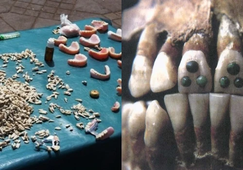 Majowie mieli lepszych dentystów niż my? Wszystko przez niezwykły ząb