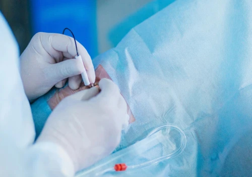 W Sosnowcu skrócili kolejki z 3 lat do roku. Pacjenci przyjeżdżają z całej Polski