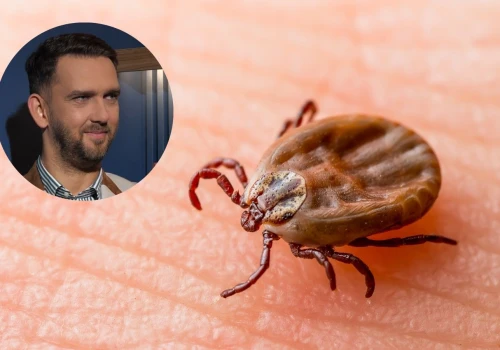 Po tym poznasz, że masz boreliozę. Objawy są charakterystyczne