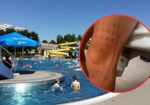 7-latek „zassany” przez atrakcję na pływalni w Częstochowie. Policja wyjaśnia okoliczności zdarzenia