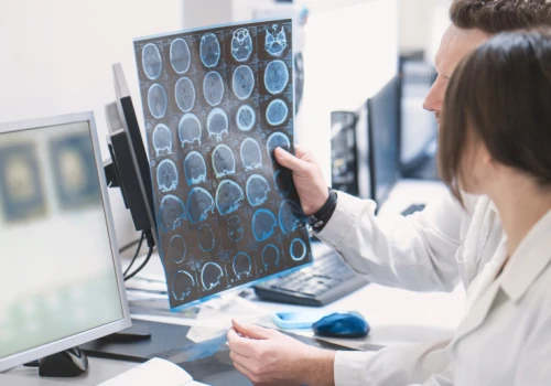 Apelują o Krajową Sieć Neurologiczną. 