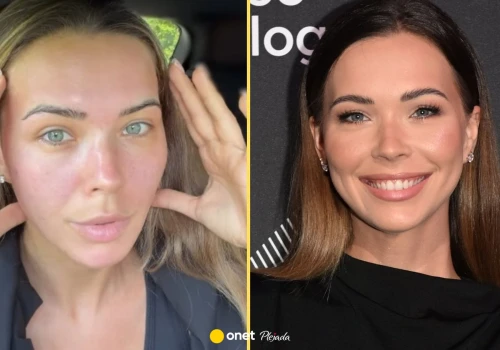 Sandra Kubicka czeka na operację plastyczną. 