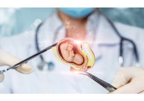 Chicago kolebką aborcyjną dla Amerykanek