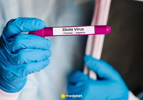 Rekordowa epidemia eboli w Kongu. Ponad 2 tys. ofiar i 4 tys. zakażonych