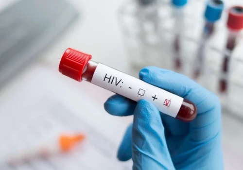 Drugie podejście. Jest nowy projekt w sprawie finansowania diagnostyki HCV i leczenia HIV
