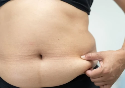 BMI już nie taki strategiczny. Tłuszcz brzuszny lepiej prognozuje ryzyko chorób serca