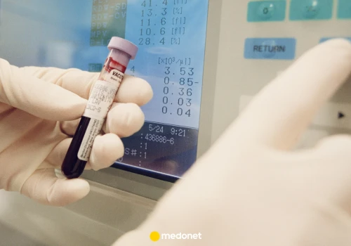 Nowe wytyczne dla cholesterolu LDL. W USA zaostrzyli podejście. Takie są progi