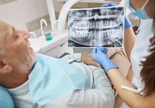 All-on-6 - odbudowa całego łuku zębowego na sześciu implantach