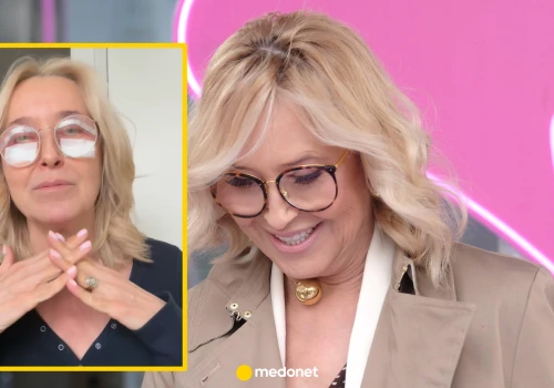 Agata Młynarska poddała się blefaroplastyce. Żałuje jednego