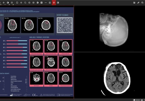 Polska jako pierwsza w Europie wdroży AI w diagnostyce na skalę ogólnokrajową