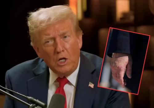 Co się dzieje Trumpem? Makijaż nie pomógł, TO zdjęcie wszystko zdradziło. „Zdeformowana dłoń”