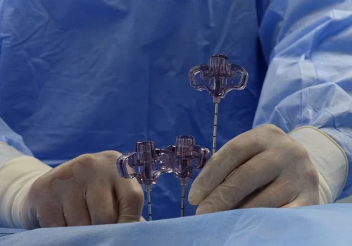 Robot pomaga operować kręgosłup we Włocławku. Neurochirurdzy wykonali już cztery zabiegi Mazor X