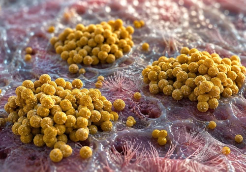 Eradykacja MRSA w mukowiscydozie: aktualizacja Cochrane nie potwierdza skuteczności rutynowego leczenia