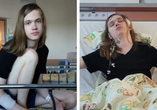 Lubelski student biomedycyny walczy z agresywnym guzem mózgu. Rodzina prosi o pomoc
