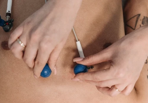 Niski i wysoki poziom testosteronu może zwiększać ryzyko migotania przedsionków