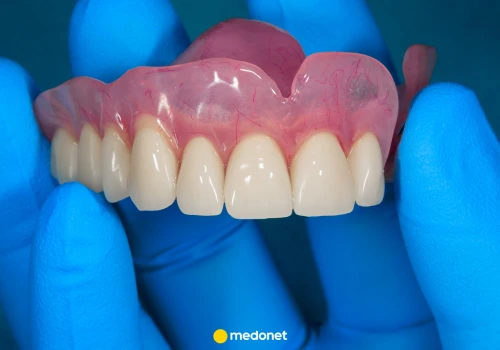 Jaka jest najlepsza proteza zębowa? Dentystka tłumaczy, jakie są opcje