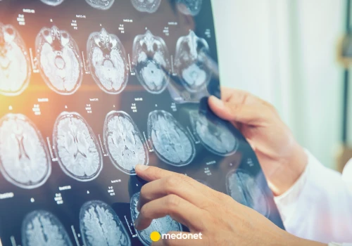 Badacze znaleźli w mózgu dwa odrębne systemy. To może zmienić leczenie chorób neurologicznych