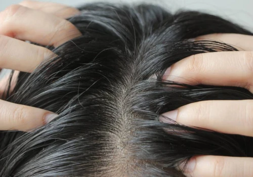Wyrok na tłuste włosy. Ten szampon działa jak pochłaniacz sebum