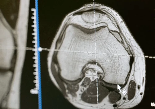 Cienki implant pozwala badać aktywność kilku obszarów mózgu jednocześnie