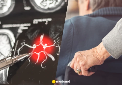 Nowe leki na chorobę Alzheimera zmieniają zasady gry. Czechy mają oczekujących pacjentów