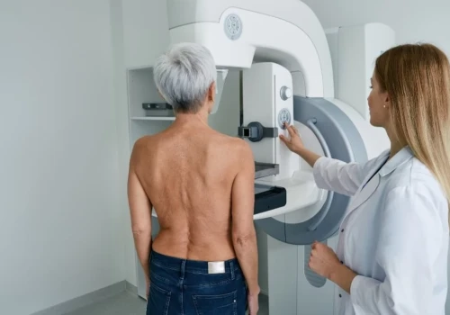 Centrum e-Zdrowia: zostało ponad 377 tys. wolnych terminów na mammografię w najbliższych 90 dniach