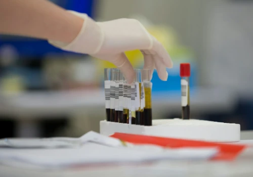 Przełom w pediatrii! Nowy test krwi oszczędzi niemowlętom niepotrzebnych antybiotyków!