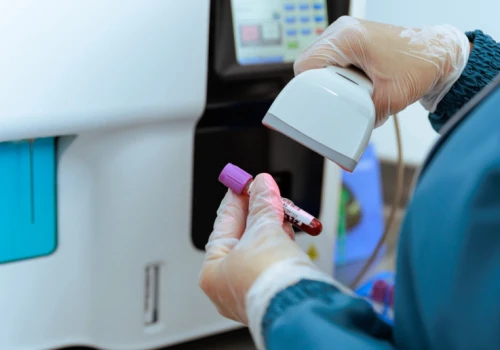 Badanie krwi zawsze na czczo: naukowcy podważyli taką konieczność. Zbadali ponad 100 tys. osób