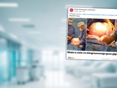 60-latka miała gigantycznego guza. "Po usunięciu brzuch się zapadł"