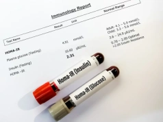 Rewolucja w medycynie: prosty test krwi pomoże wcześniej wykrywać Alzheimera