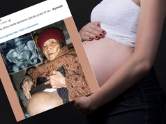 Zaszła w ciążę w 1948 roku. Lekarze wyjęli płód po 61 latach