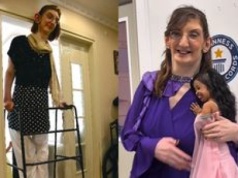 Rumeysa Gelgi jest najwyższą kobietą świata. Z powodu choroby, jako 6-latka, miała już 180 cm wzrostu. Jak wygląda jej życie?