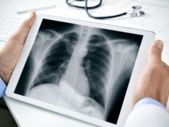 Nowy model AI diagnozuje choroby płuc trafniej niż lekarze