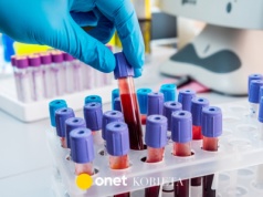 Ta grupa krwi zwiększa ryzyko raka trzustki. Zaskakujące odkrycie naukowców