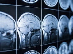 Powstał przełomowy implant mózgu. Pozwala mówić i śpiewać, i to bez opóźnień