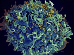Jak wywabić wirusa HIV z komórek? Naukowcy znaleźli sposób