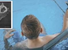 Dziecko zmarło przez amebę zjadającą mózg. Park wodny zamknięto