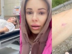 Doda pokazała BLIZNĘ po operacji czerniaka. To dla niej symbol odwagi