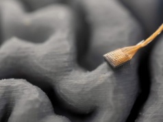 Implant w mózgu oddaje nie tylko głos, ale i styl wypowiedzi. Adekwatność szokuje