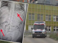 11-latek w ramach wyzwania połknął kilka petard. Matka wyjaśnia