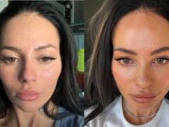 Sylwia Szostak pokazała, jak botoks zmienił jej twarz. 