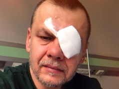 Artur Rawicz: „Zdiagnozowano u mnie raka”