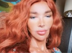 Ewa Minge o liftingu, implantach i modzie na operacje. Ostrzega przed zabiegami w Turcji