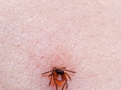 Ekspertka: Mamy szczyt sezonu zakażeń boreliozą