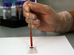 PolTREG ma pozytywną opinię FDA z pre-IND ws. terapii PTG-007 u dzieci z cukrzycą typu 1